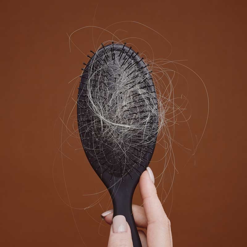 Haaruitval en kaalheid bij vrouwen